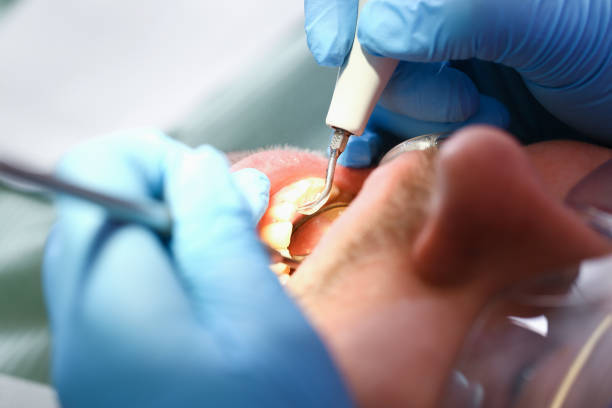 Best Weekend Emergency Dentist in Yorkvle, IL
