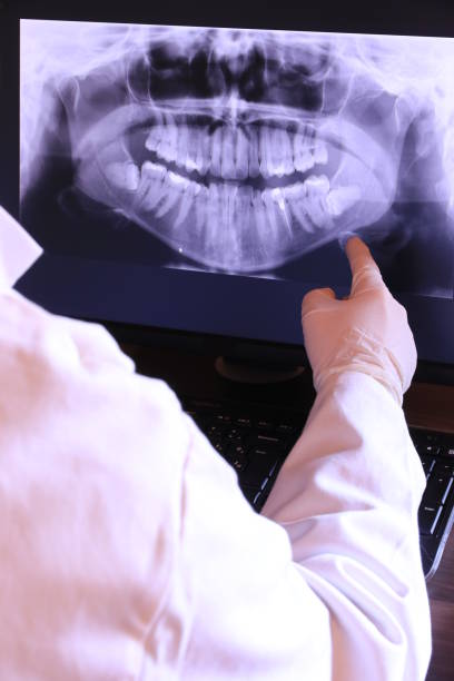 Best Emergency Tooth Extraction in Yorkvle, IL